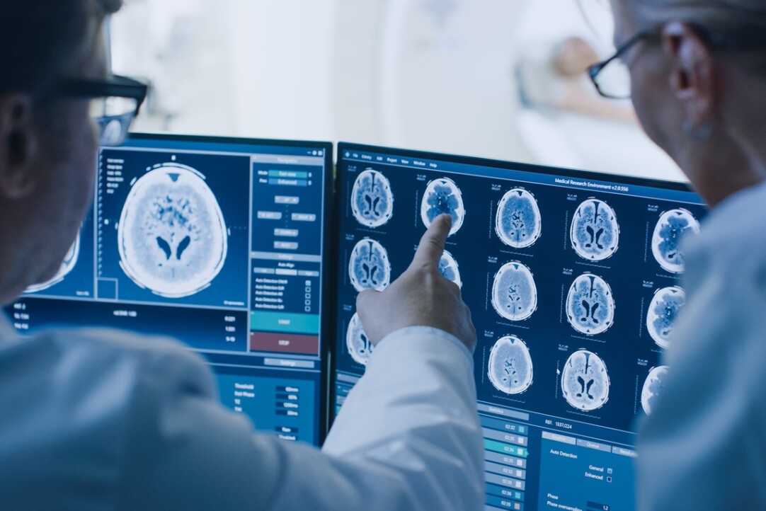 Machine Learning Links Two New Genes to Ischemic Stroke Illustration for news: Machine Learning Links Two New Genes to Ischemic Stroke